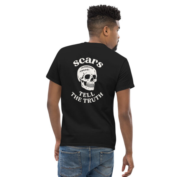 Model wearing a black Varbridge t-shirt with a large back print of a scarred skull and the phrase “Scars Tell The Truth” in bold white text